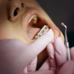 profitable dental procedures